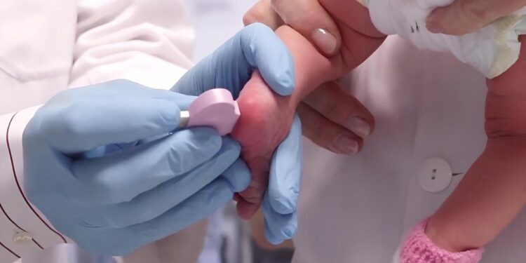 Castilla-La Mancha amplía las enfermedades metabólicas detectadas por la prueba del talón