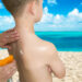 Una quemadura solar en la infancia duplica el riesgo de sufrir cáncer de piel de adulto